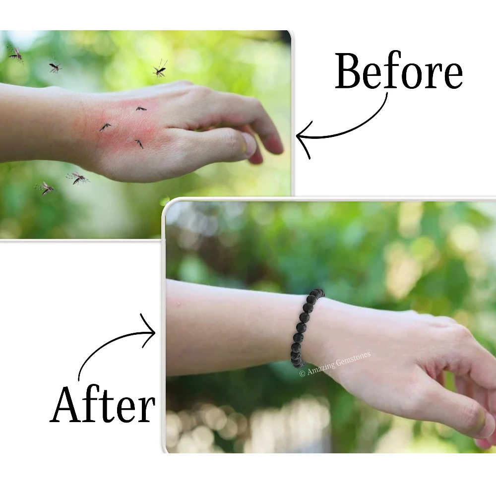 Lava Stone Mosquito Repellent Bracelet Anklet Set with Essential Oil (Pack of 4)