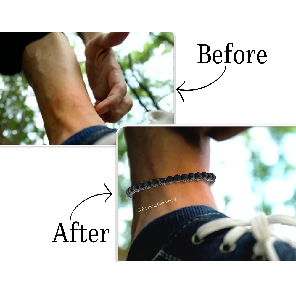 Lava Stone Mosquito Repellent Bracelet Anklet Set with Essential Oil (Pack of 4)