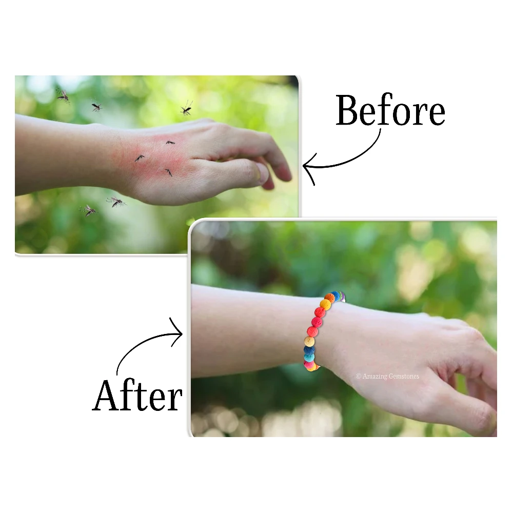 Lava Stone Mosquito Repellent Bracelet Set with Essential Oil (Pack of 10)